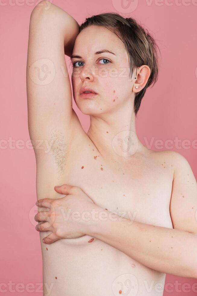 The woman raises her hand and shows her unshaven hairy armpits. Body positivity, feminism and the concept of body care. A vertical snapshot. photo