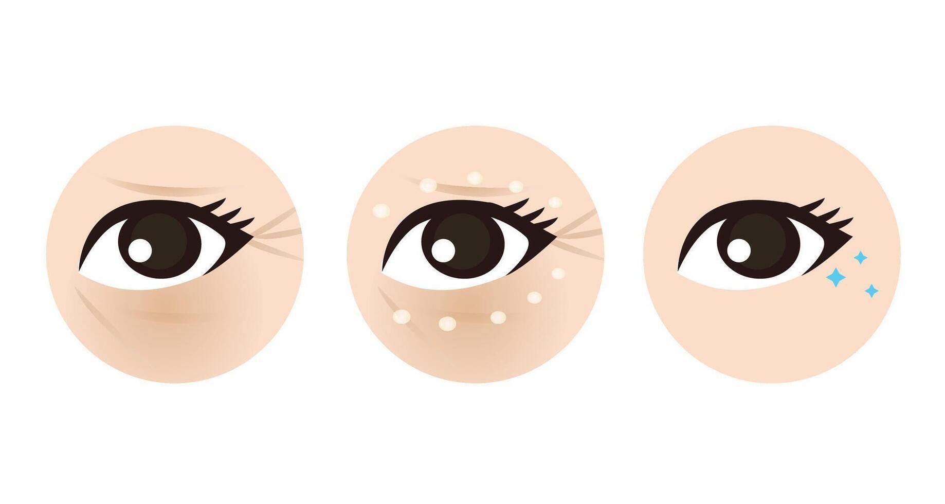Direction for use eye cream treatment icon set illustration isolated on white background. Apply eye cream to treat under eye bags, reduce dark circles, puffiness, dryness, crow feet lines. vector