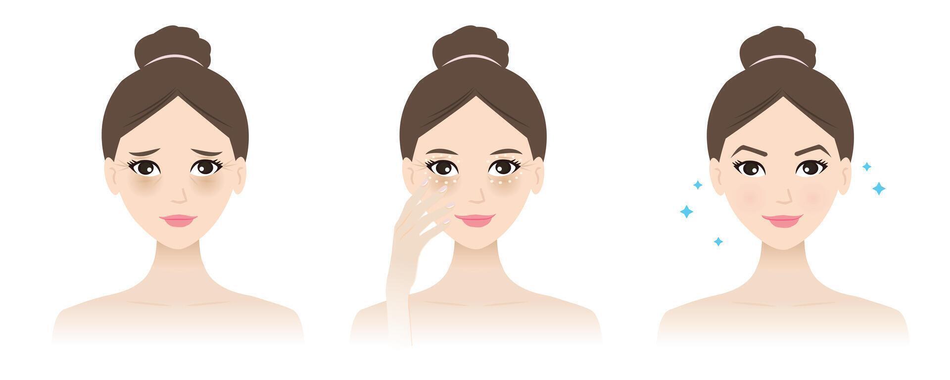 The cute woman with eye cream treatment illustration on white background. Direction for use eye serum to reduce dark circles, under eye bags, puffiness, dryness, tear troughs, crow feet lines. vector