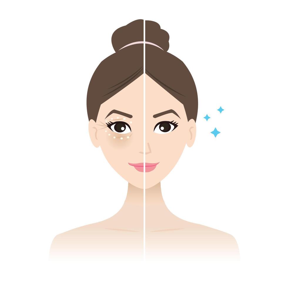 Before and after apply eye cream treatment illustration on white background. The cute woman apply eye cream to treat under eye bags, reduce dark circles, puffiness, dryness, crow feet lines. vector
