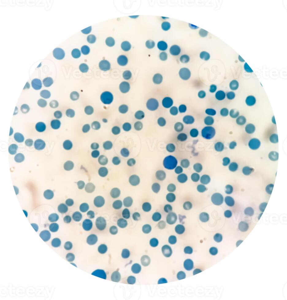 Close microscopic view of abnormal reticulocyte count in hematology department, photo