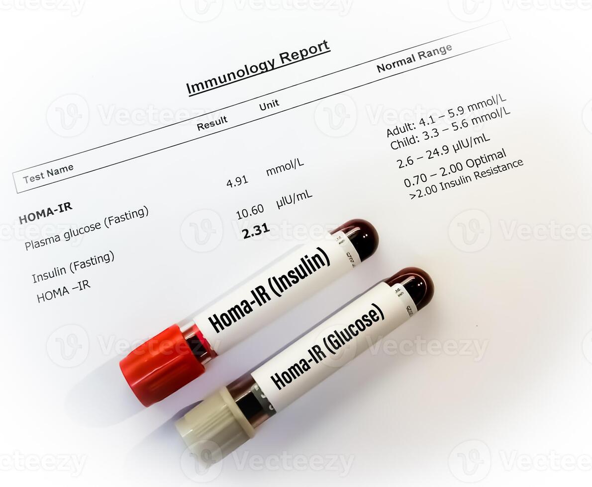 HOMA or Homeostatic Model Assessment Index or HOMA-IR test is a blood test used to diagnose a person's insulin resistance level. photo