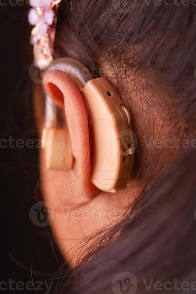 Hearing aid concept, little girl with hearing problems. photo