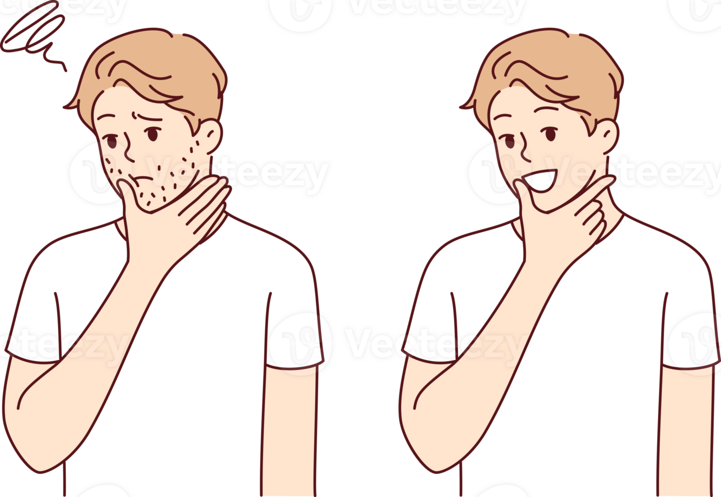 Pimples and spots on man face disappeared after using medical medicine or cosmetic product. Comparisons of healthy patient with sick guy who fell victim to sweating disease that causes acne png