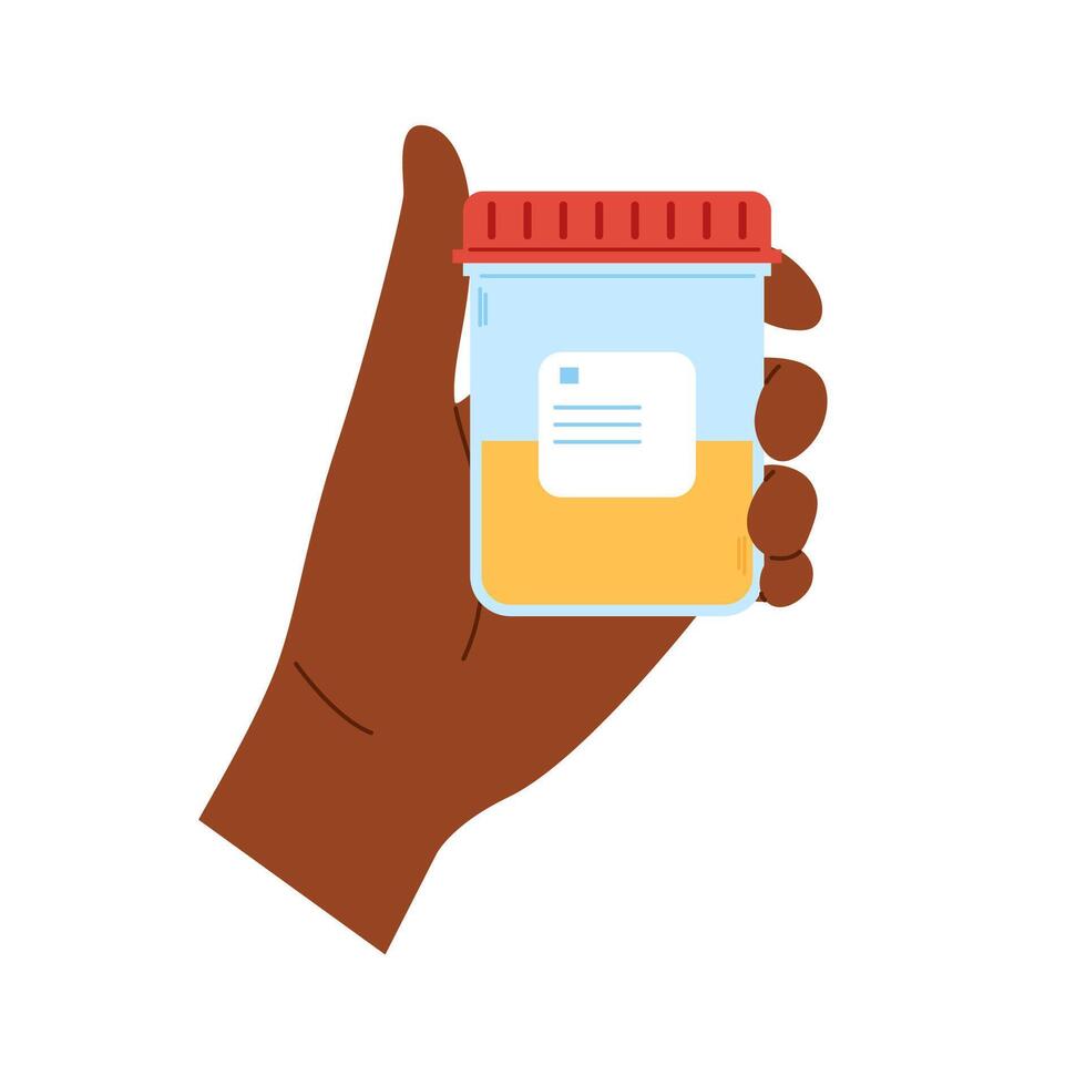 African hand holds container with urine sample. Plastic containers with biomaterial. Urine analysis vector