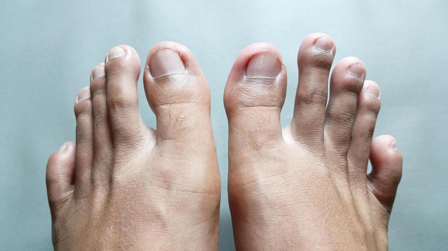 Male toes on gray background, man's feet. photo