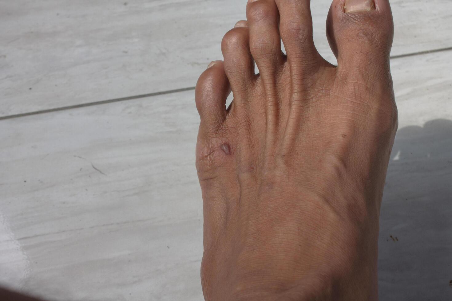muscular back of the foot photo