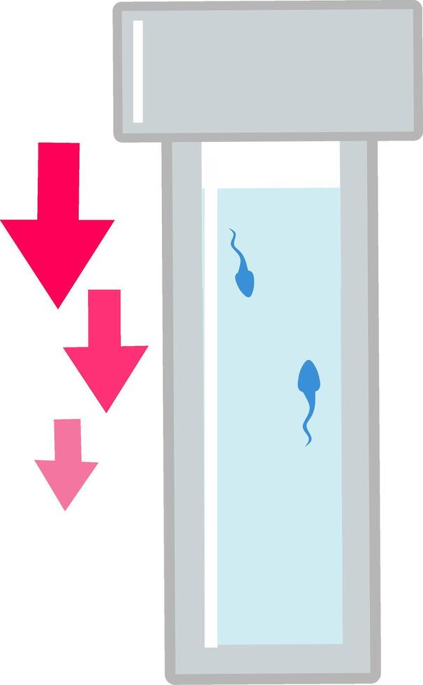 Poor low sperm analysis count for ivf procedure conceptual illustration of the mciroscope and sperm cells. Fit to show step by step of ivf procedure vector
