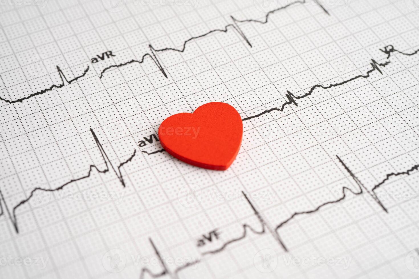 Electrocardiogram ECG graph paper with red heart, heart wave, heart attack, cardiogram report. photo
