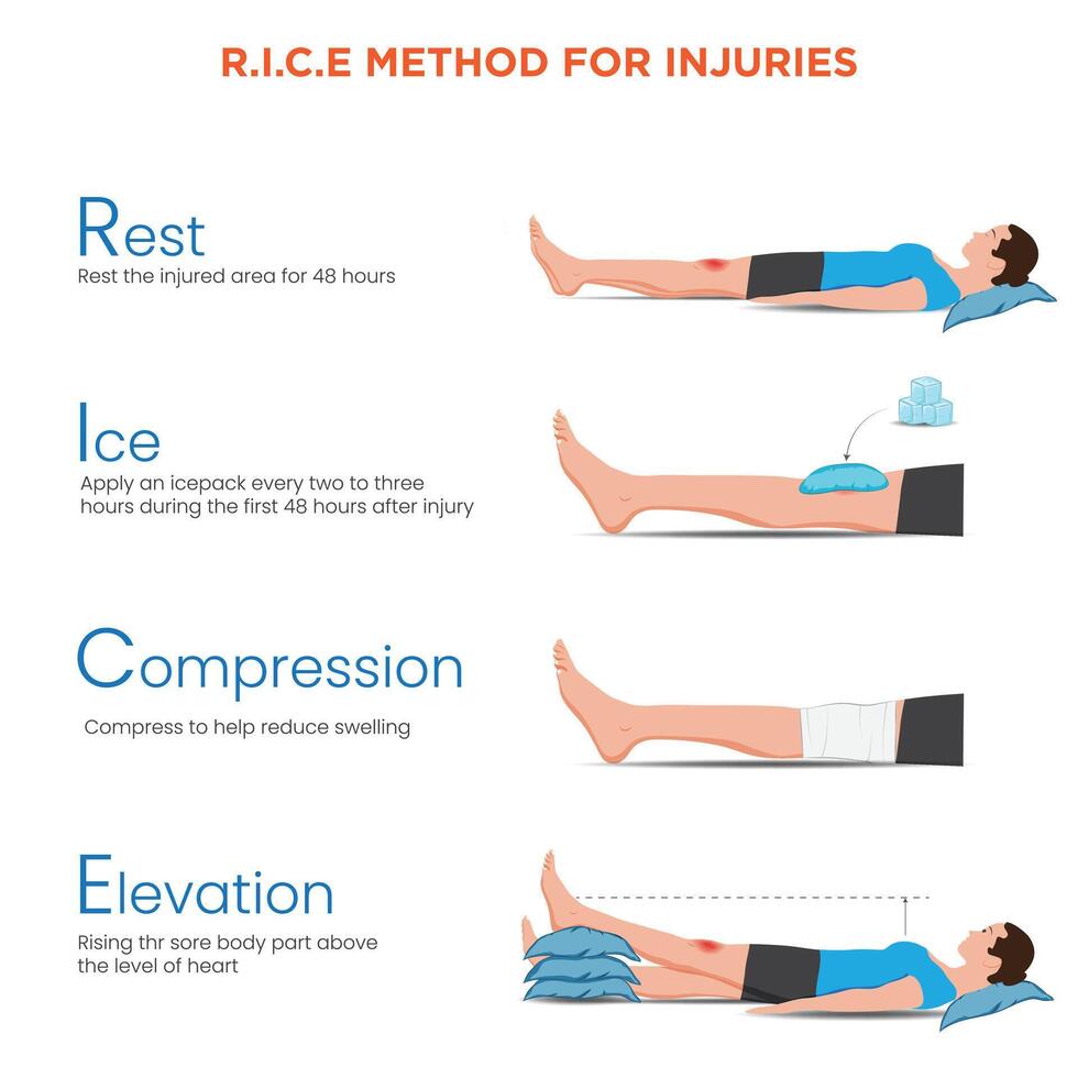 R.I.C.E Method for Injuries Rest, Ice, Compression, and Elevation for Quick Recovery vector