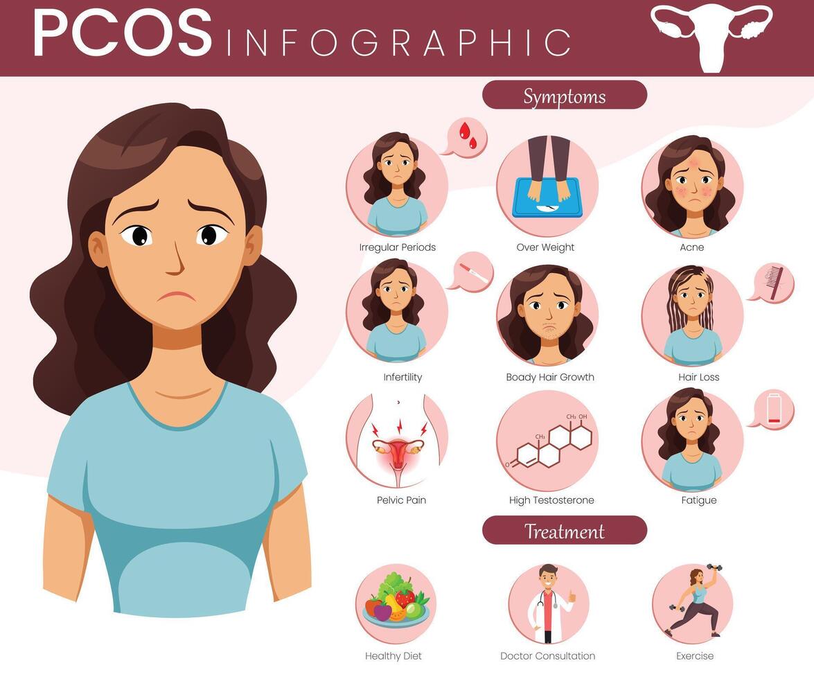 A Visual Guide to Polycystic Ovary Syndrome vector