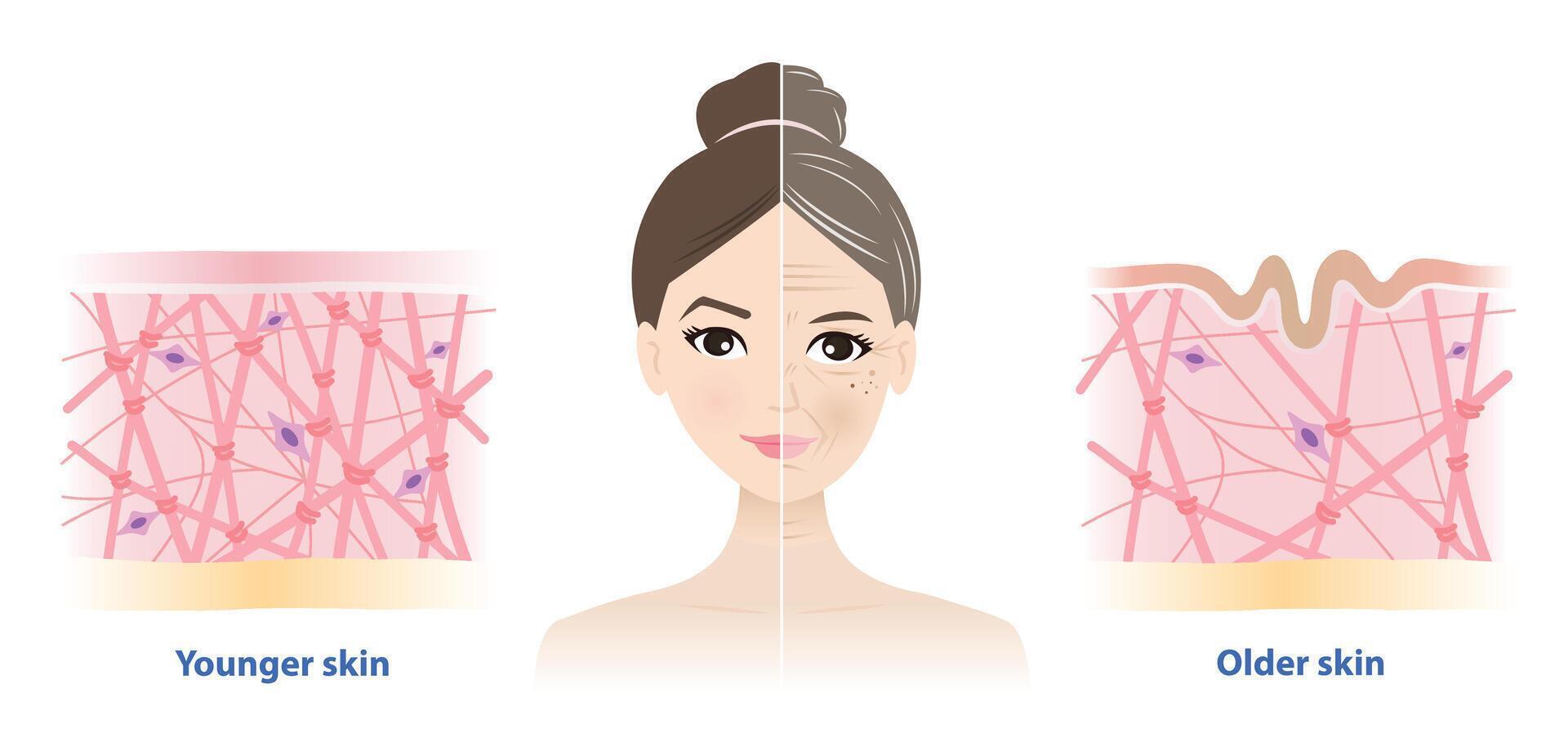 The difference between young and aging skin on woman face illustration. Aging process comparison. Cross section of high and low density of collagen, elastin fibers and fibroblasts in dermis. vector