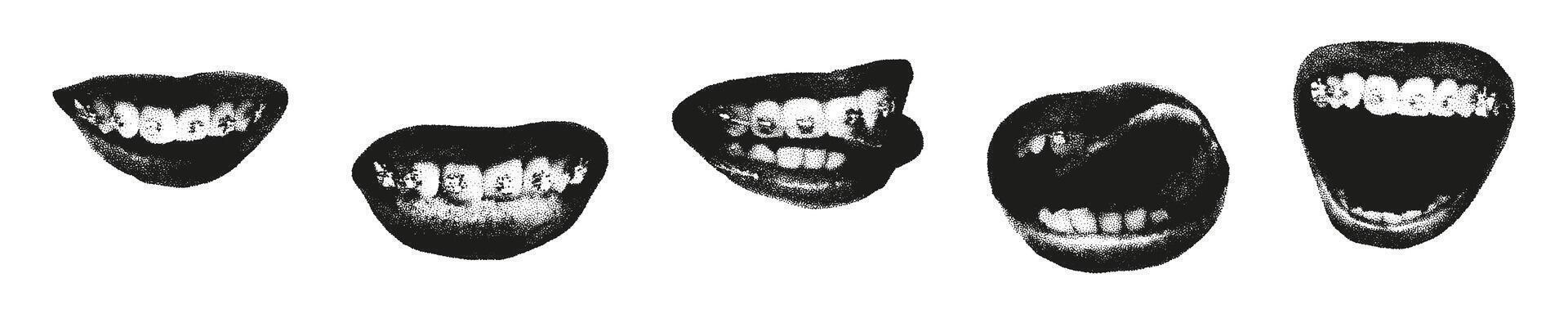 Trendy halftone photocopy stipple effect elements. Grunge punk collage art of female mouths with a grainy dotted texture. Smiles, lips, teeth with braces. Modern retro illustration. vector