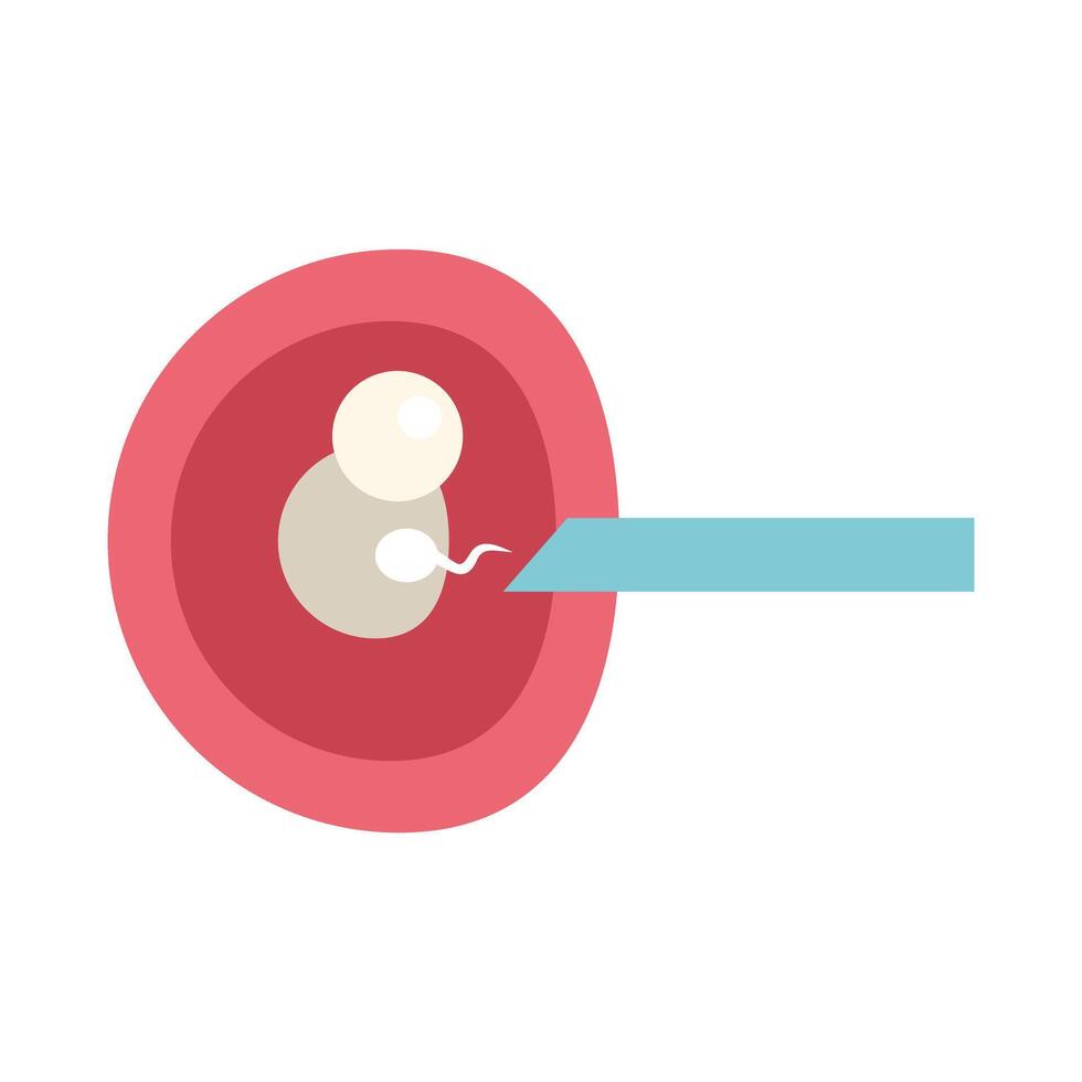 Sperm fertilizing egg inside female body during artificial insemination procedure vector