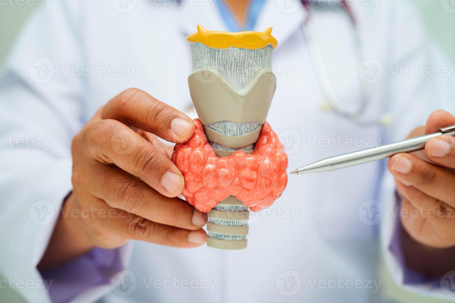 Hyperthyroidism, Overactive Thyroid, Thyroid Lymphoma, Asian doctor with thyroid gland human anatomy model in hospital. photo