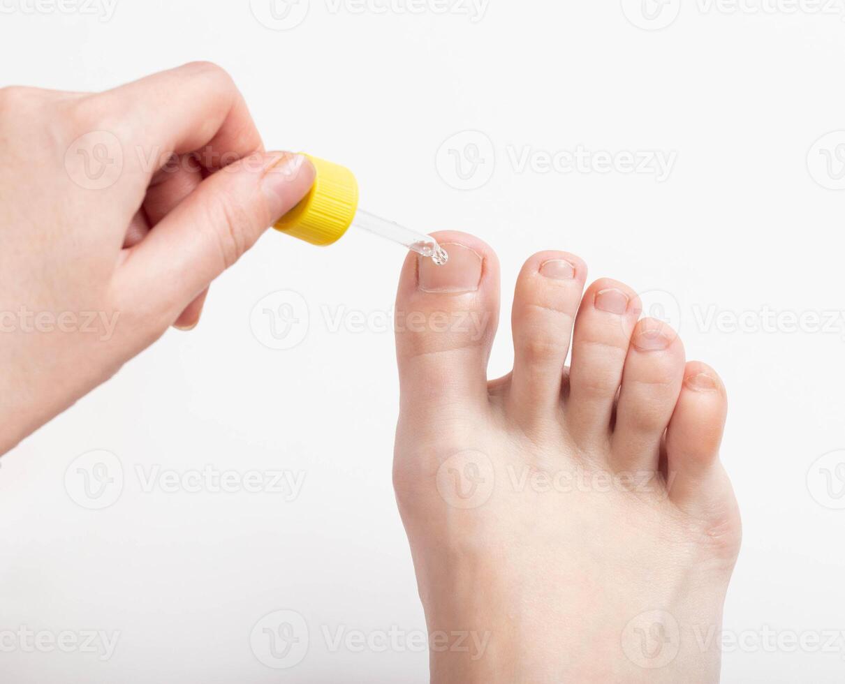 Application of a cosmetic product to the toenail to strengthen the nail and cuticle, vitamin complex. Copy space for text, inflammation photo