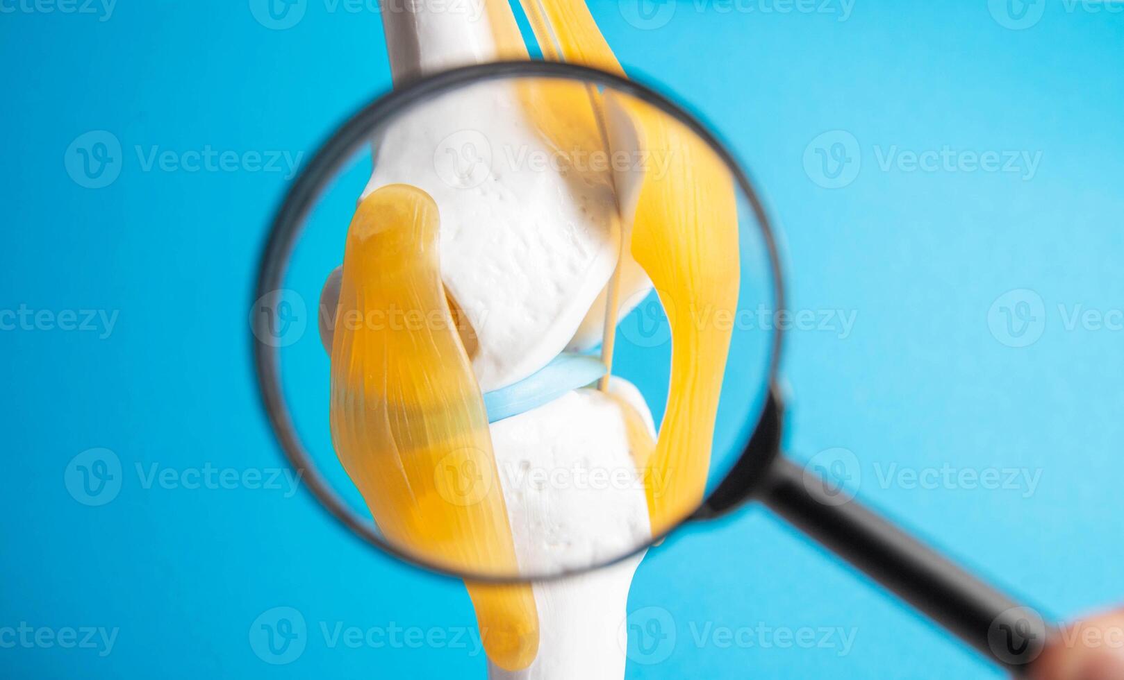 Medical mockup of a knee joint under a magnifying glass on a blue background. Knee ligament rupture and sprain concept. Knee fracture, close-up photo