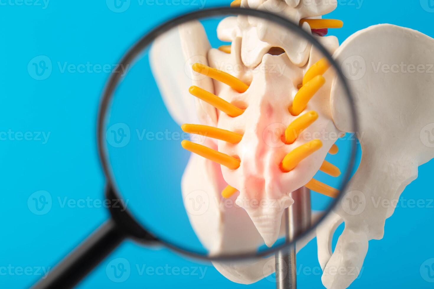 Coccyx and sacrum of the spine mockup on a blue background under a magnifying glass. Concept of degenerative spine diseases, injuries and back pain. Lordosis and lumbago, close-up photo