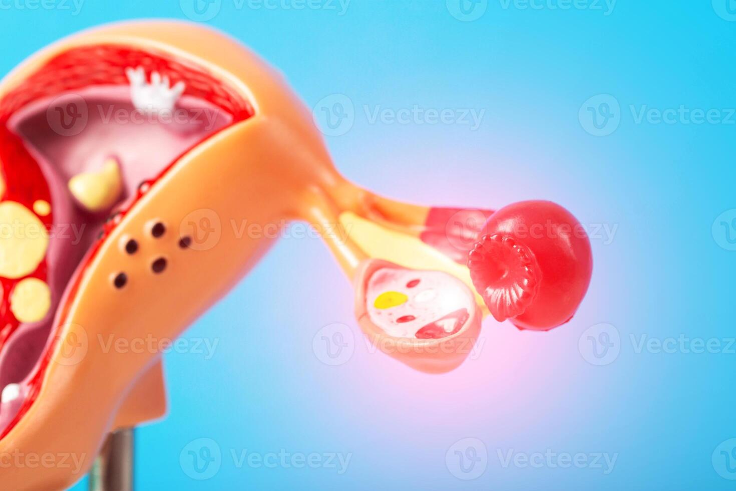 Mockup of the female reproductive system on a blue background with a red inflamed ovary. The concept of pain in the ovaries in female orgasm due to infection and microbes, close-up photo