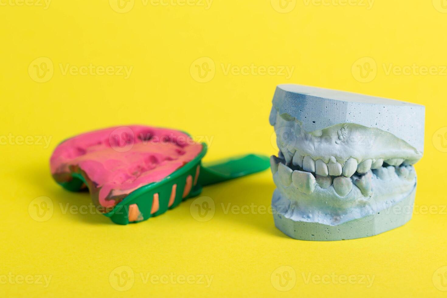 Dental spoon with alginate plastic mass for taking an impression of the dental jaw on a yellow background. Blue plaster dental jaw on a yellow background. Orthodontics in dentistry photo