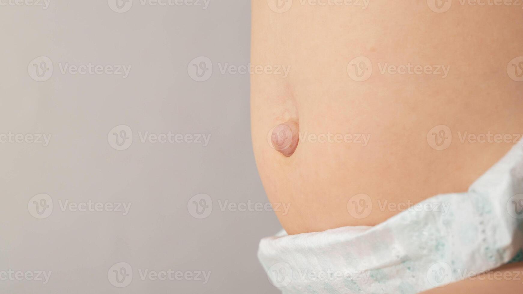 Baby belly with bulging navel on a gray background. Umbilical hernia in newborns, dilated umbilical ring, medical. Copy space for text photo