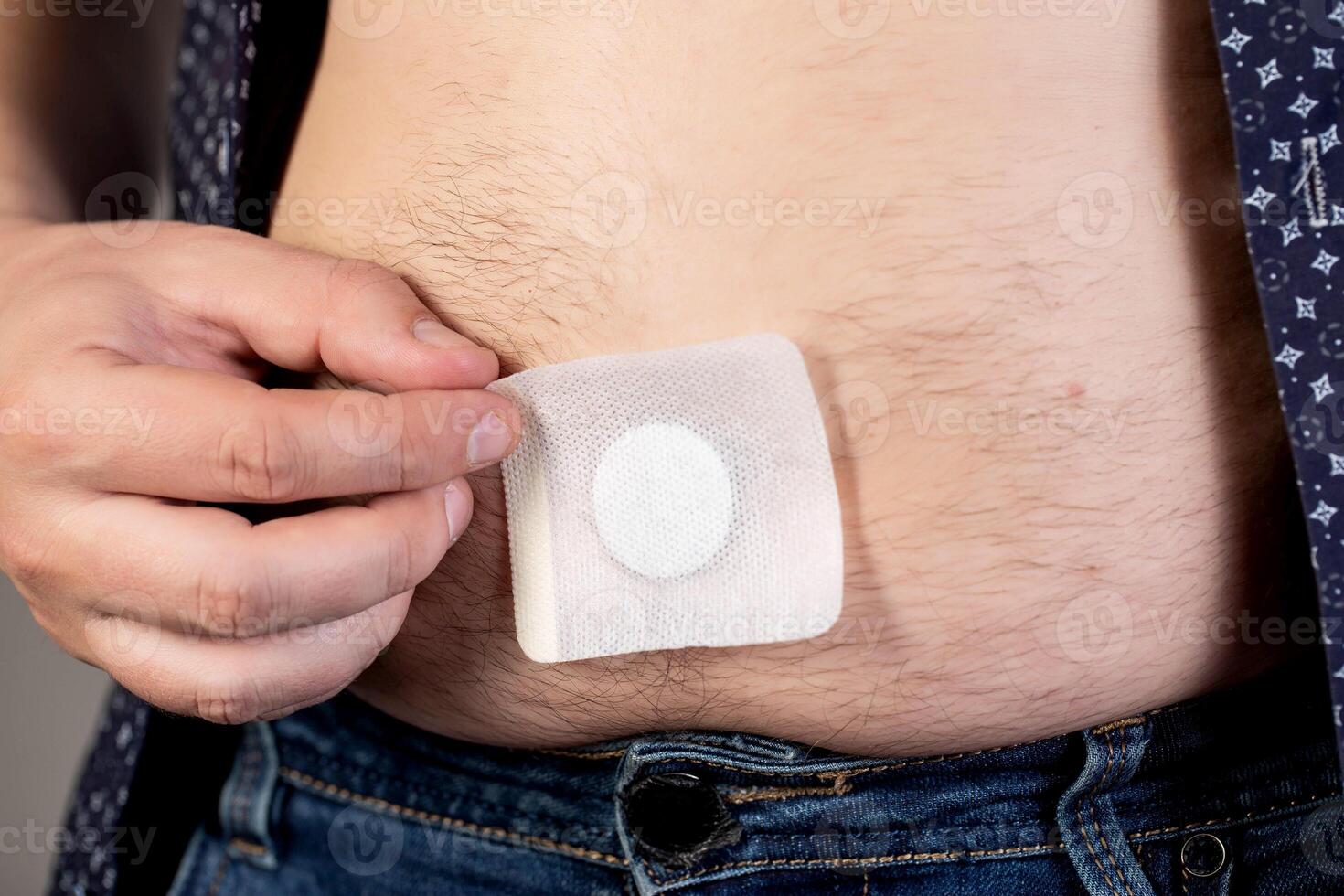 A modern medical patch for prostatitis and urinary tract infections. A man glues a urological patch on his stomach, close-up photo