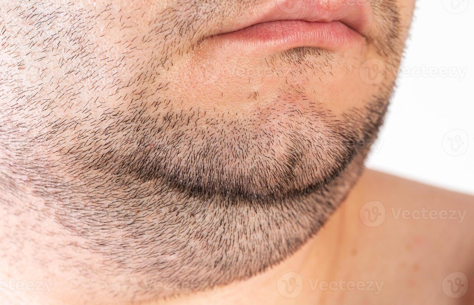 The face of an overweight man. Fat double chin. Aesthetic defect. double chin correction, close-up photo