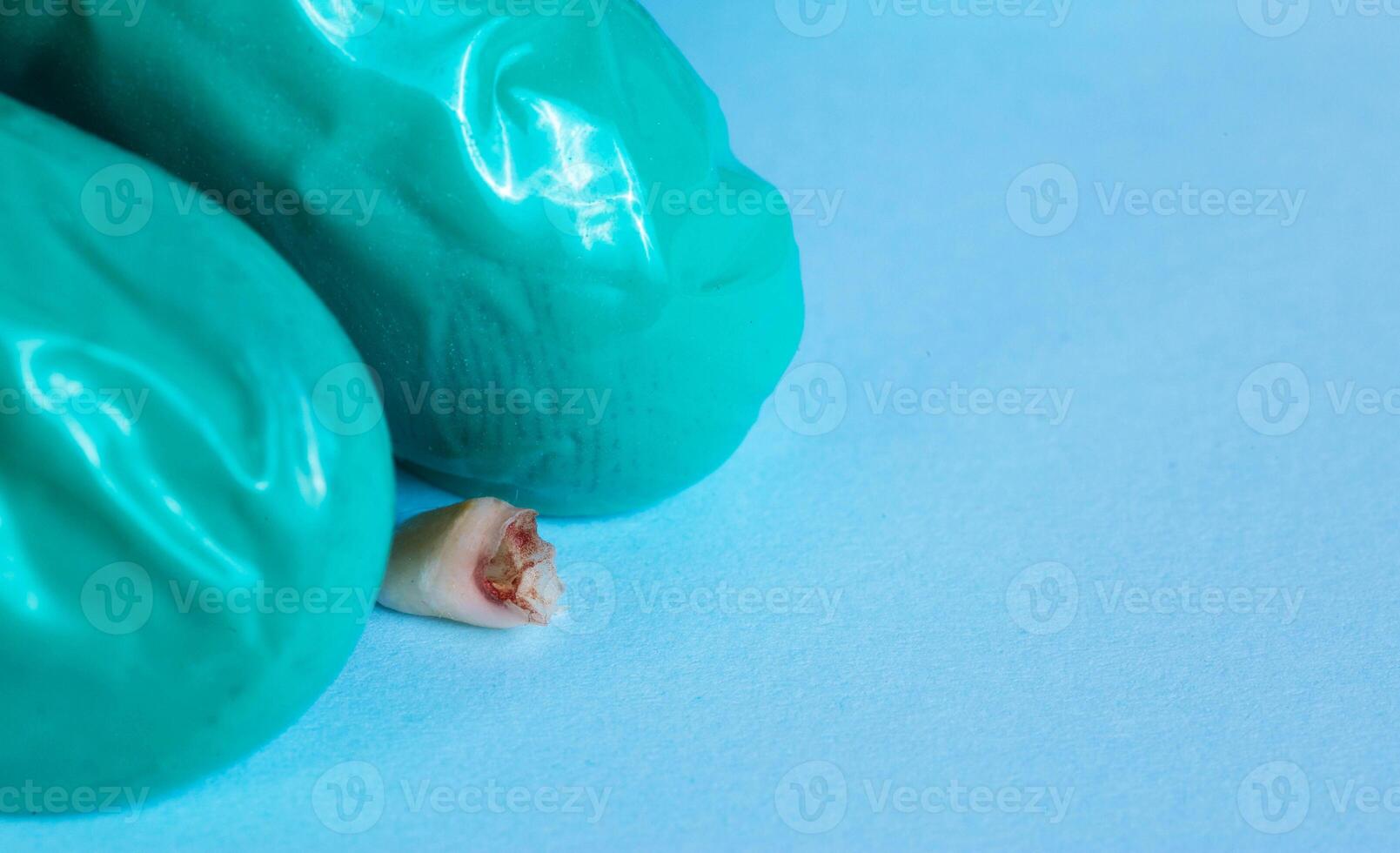 A dentist in a green glove holds a milk tooth on a blue background. Extraction of teeth in children, pediatric dentistry. Close-up photo