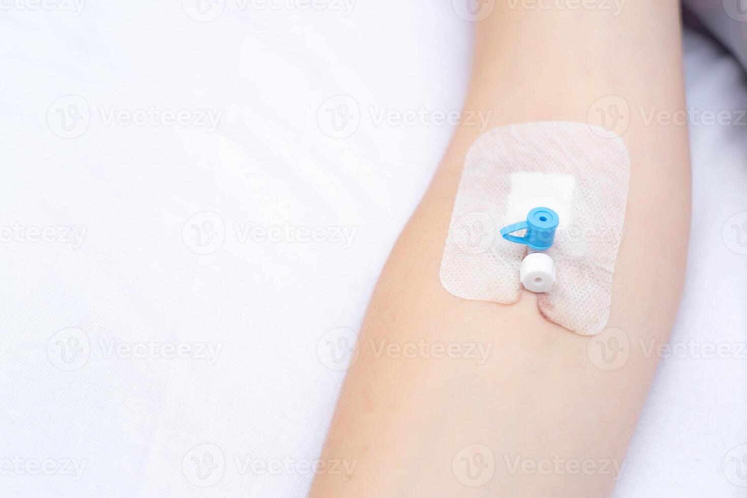 Intravenous catheter on the girl's arm for convenient injection of drugs into a vein, copy space for texr photo