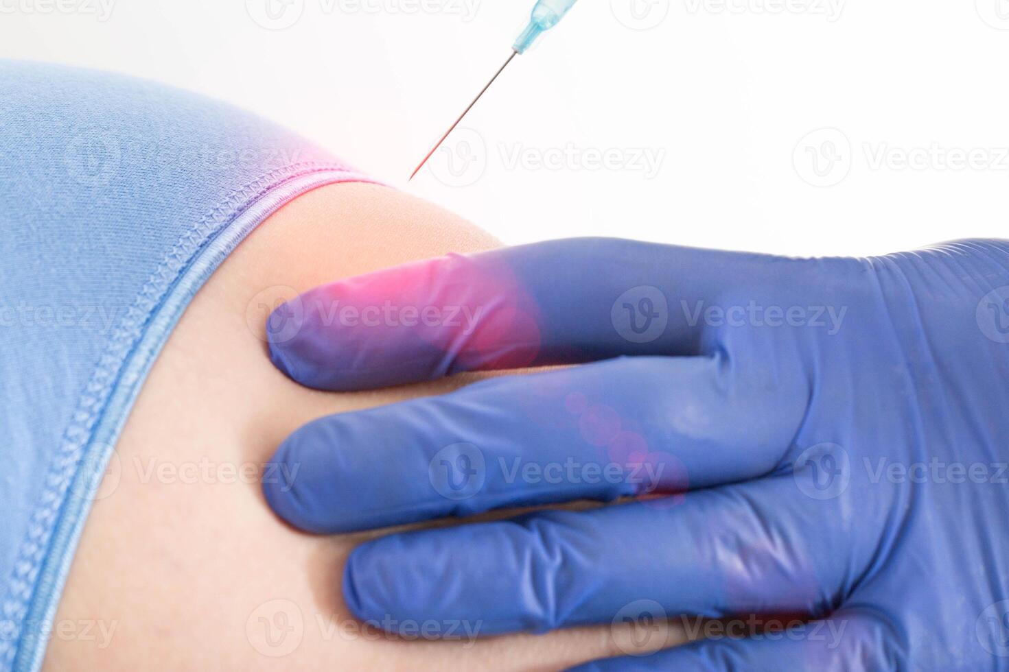 The doctor gives an anesthetic injection in the buttock for back pain. Spine treatment concept with intramuscular injections, chondroprotectors and B vitamins, close-up photo