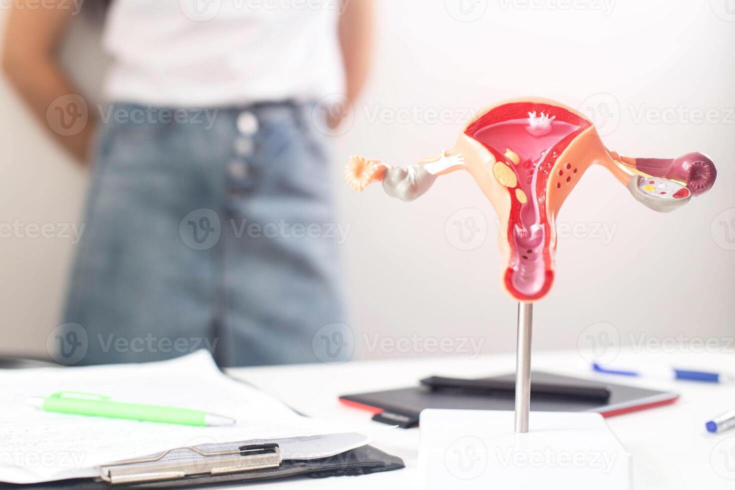 A model of the female reproductive system in the background is a girl in a doctor s office with irregular periods. The concept of problems for women with a period of menstruation, oligomenorrhea photo