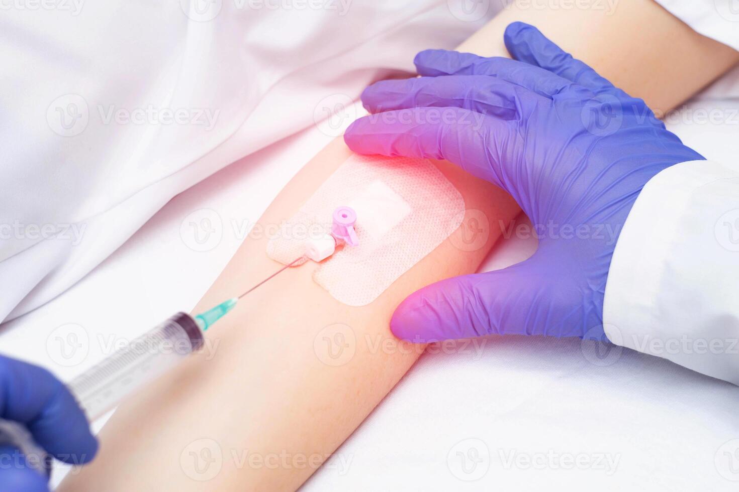 A doctor puts a venous catheter to a patient to inject drugs into a vein, close-up. Treatment photo