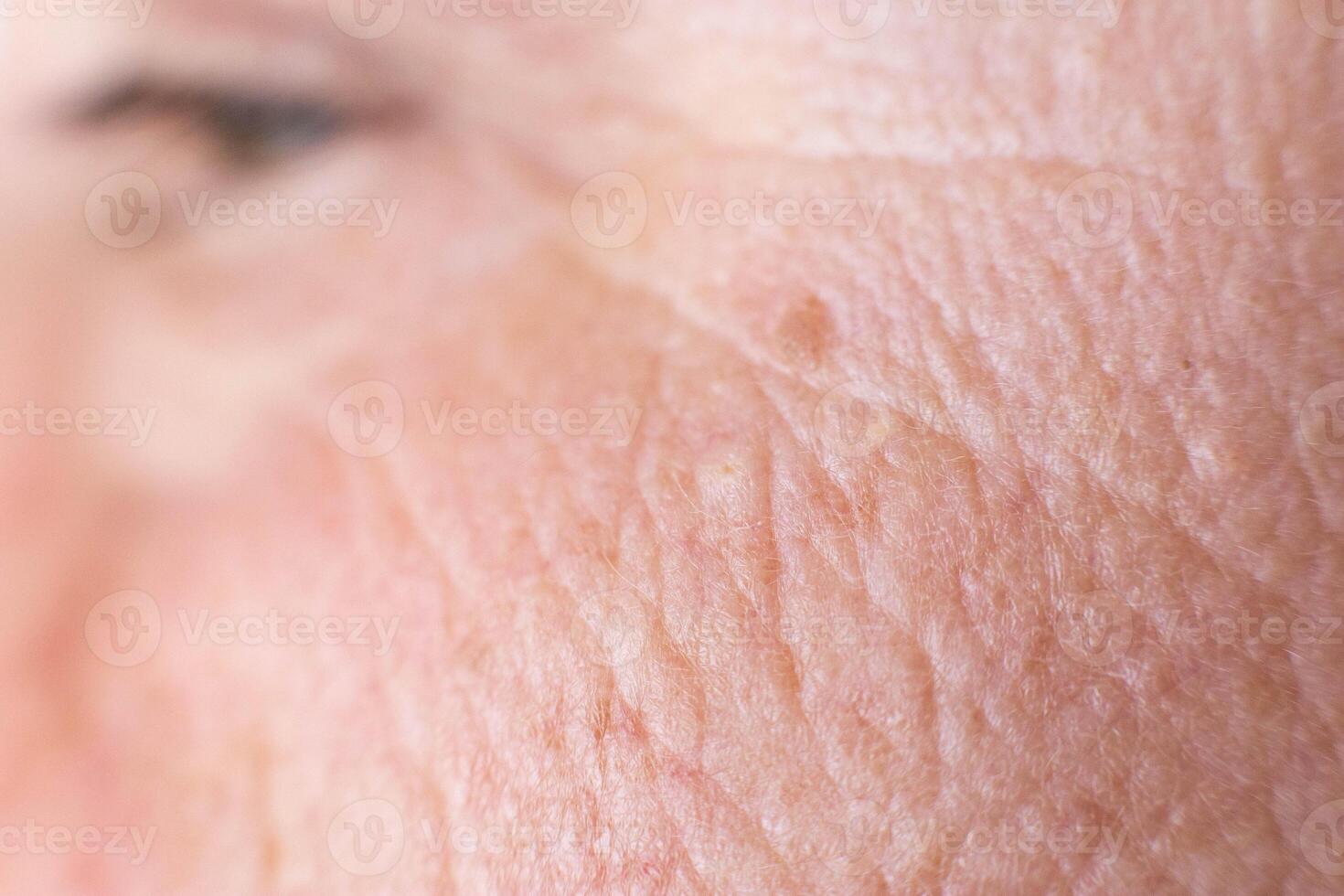age spots on the face of a woman with dry skin and wrinkles, background, macro, problem photo