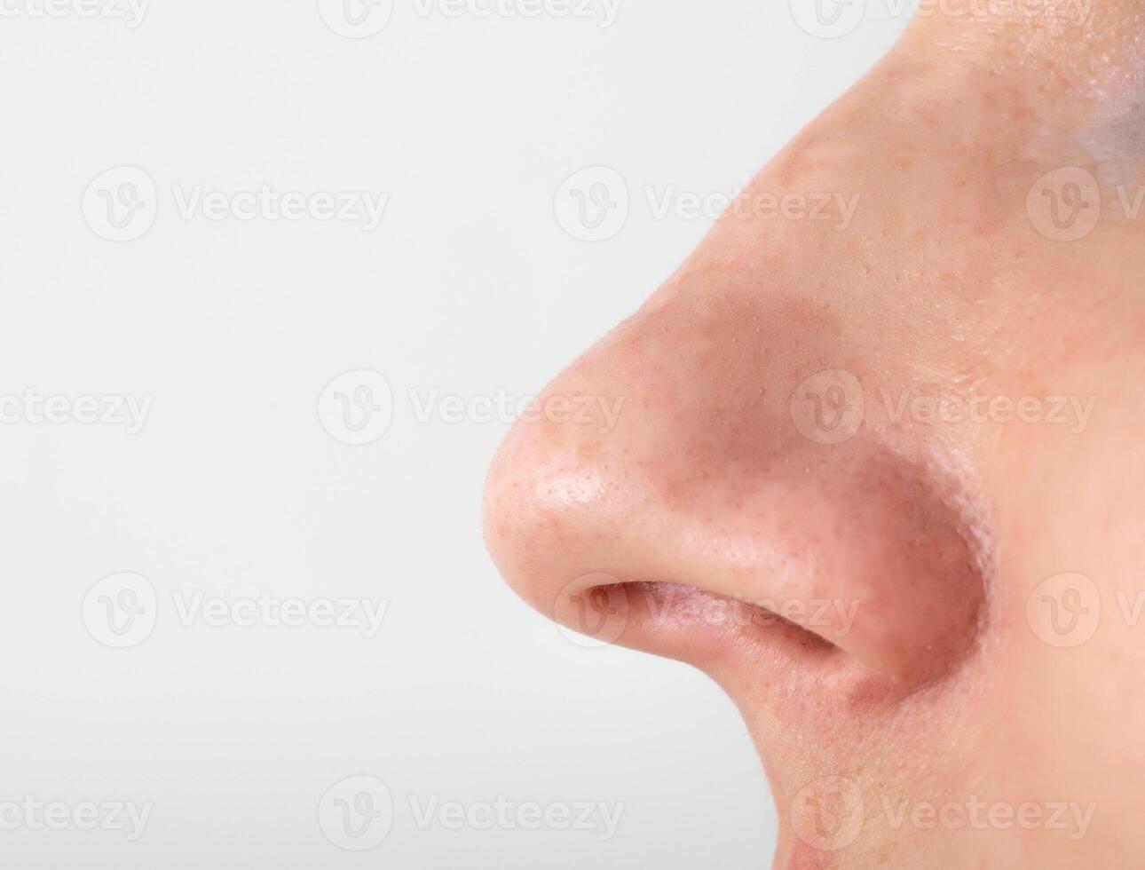 The girl has a long nose, close-up. Nose reduction plastic surgery concept, copy space for text photo