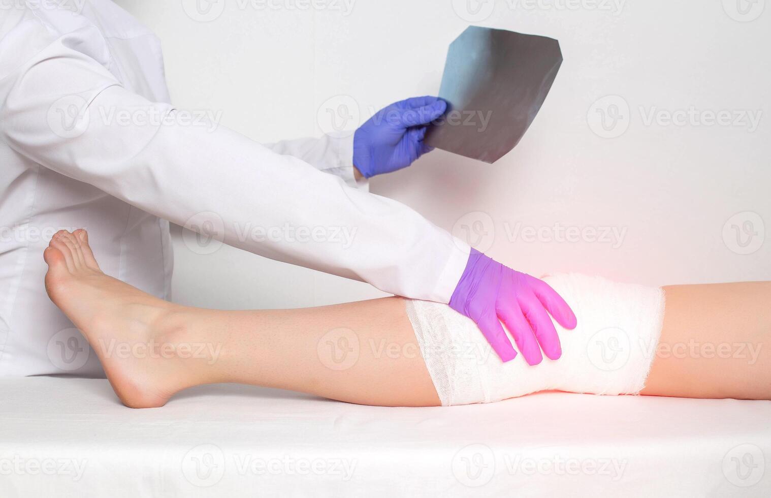 An orthopedic doctor holds an x-ray picture of a patient's knee. The concept of diseases and injuries of the knee and patella, sprain photo