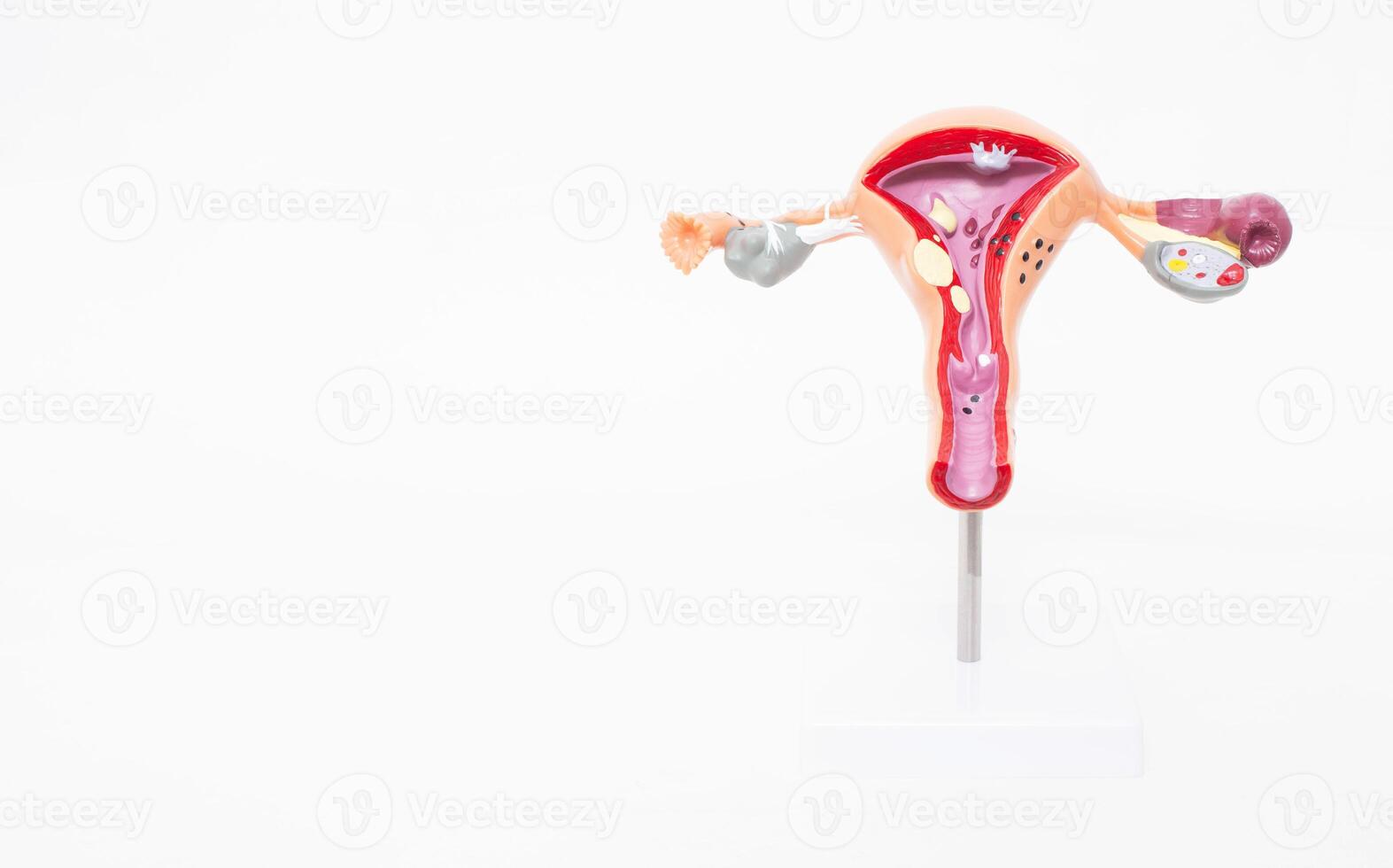 Mock female reproductive system on a white background. The concept of sexually transmitted infections, bacterial vaginosis. Copy space photo