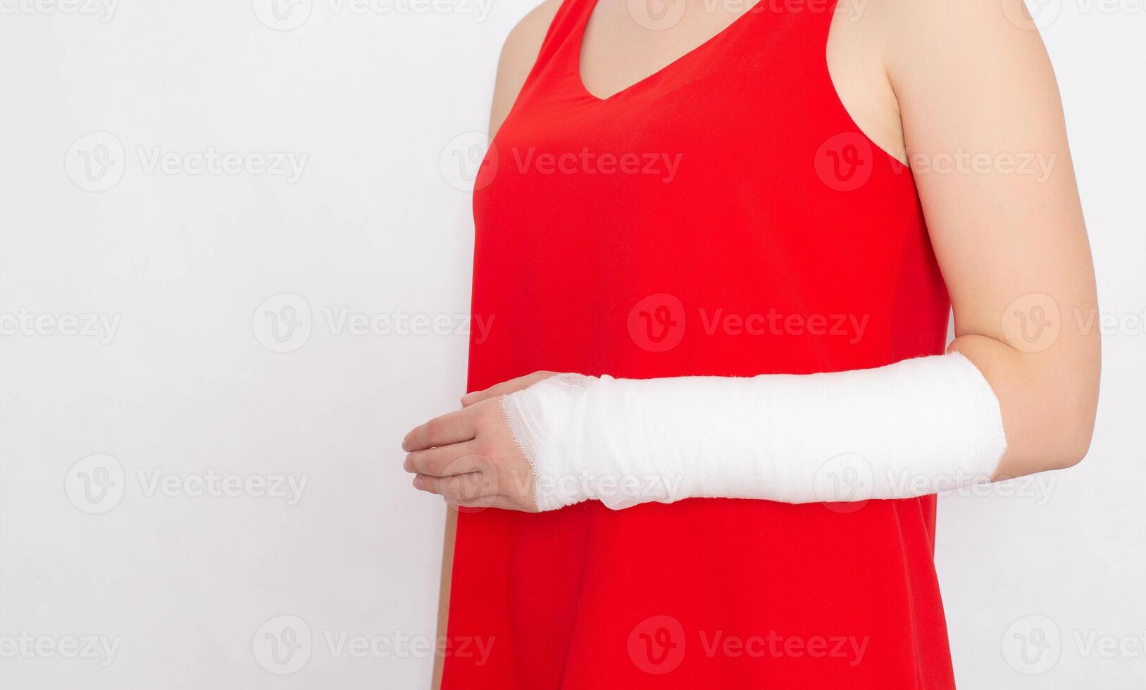 Girl in a red T-shirt with a broken arm in a tight bandage and plaster on a white background. Radial Fracture Treatment Concept, copy space photo