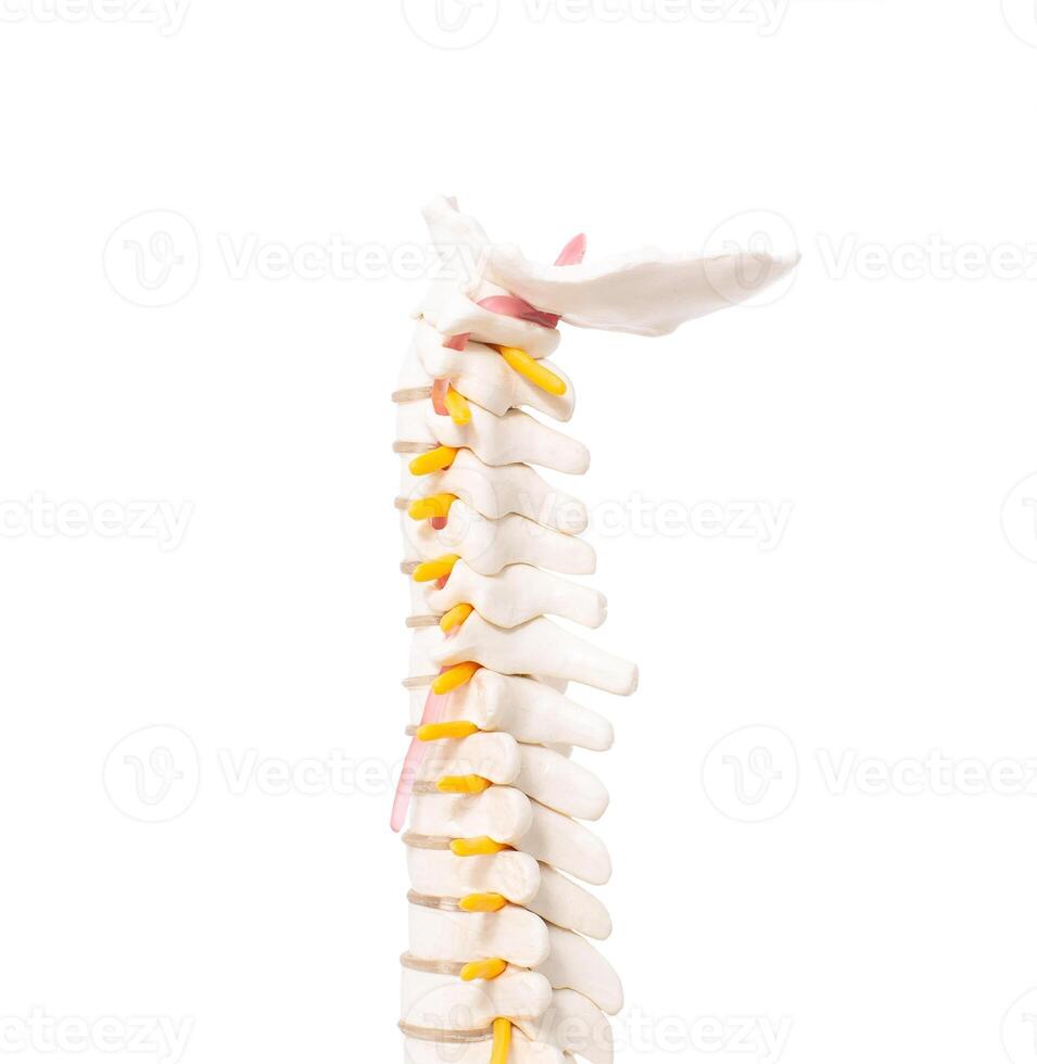 cervical and thoracic spine on a white background, isolate. Osteochondrosis and degenerative changes in the spine, microspondylia photo