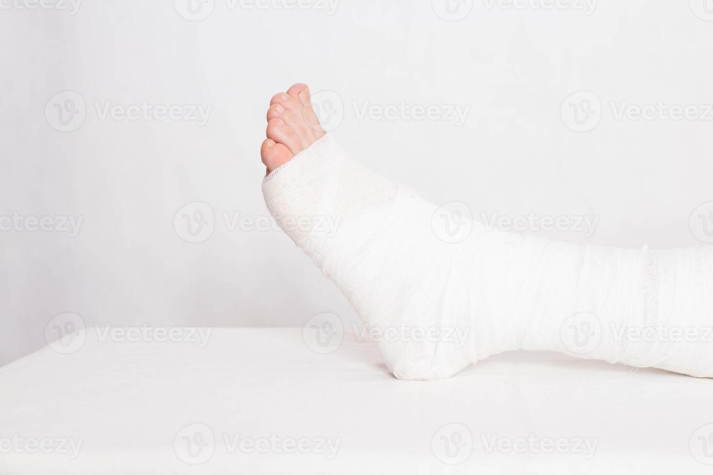 Ankle wound with a bandage in a tight fixing bandage on a white background. Concept of leg fracture and plaster bandage, hospital photo