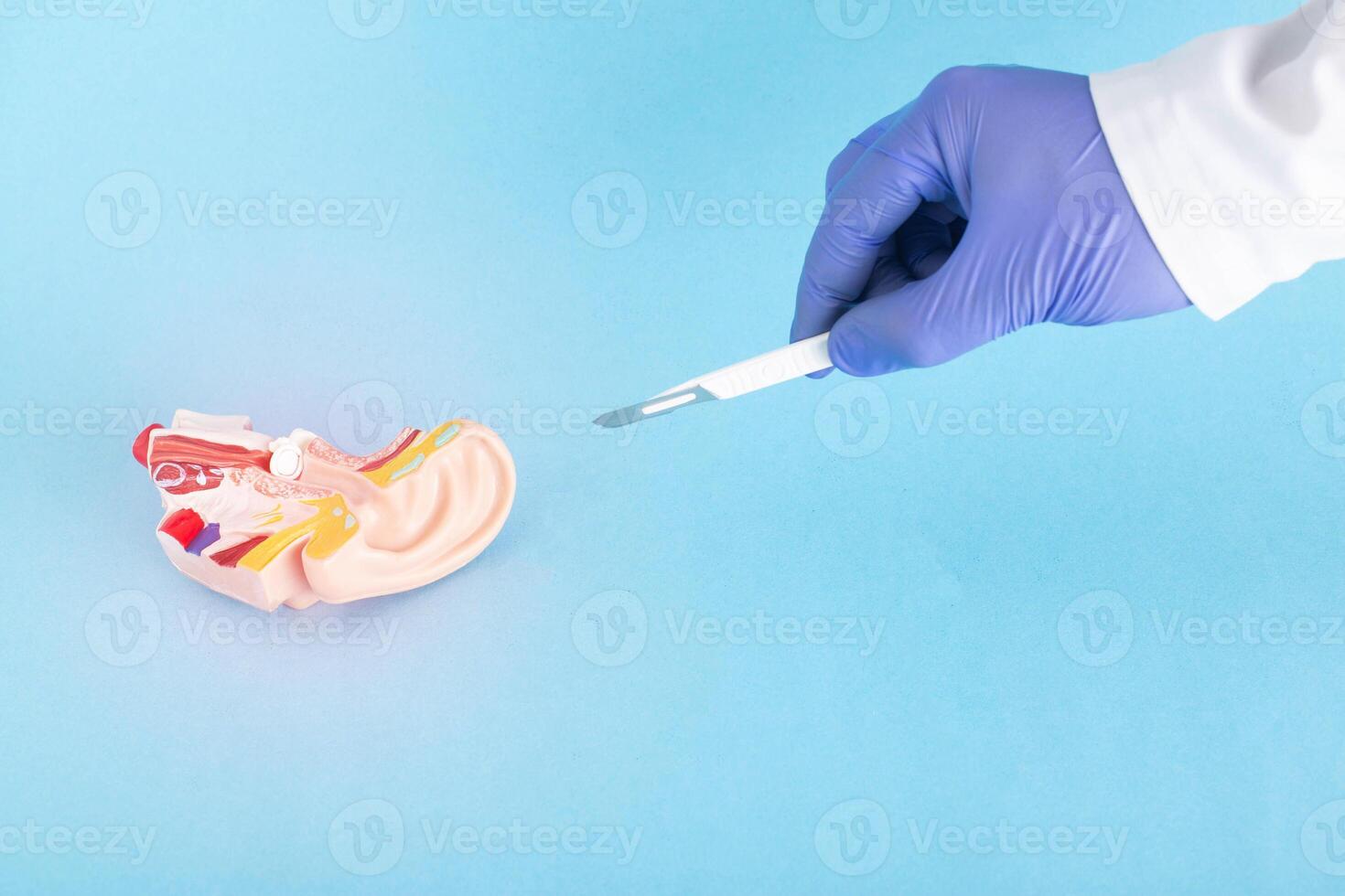 The doctor holds a scalpel on the background of the mock-up of the ear on a blue background. Ear surgery concept, copy space for text. Stapedoplasty and ossiculoplasty photo