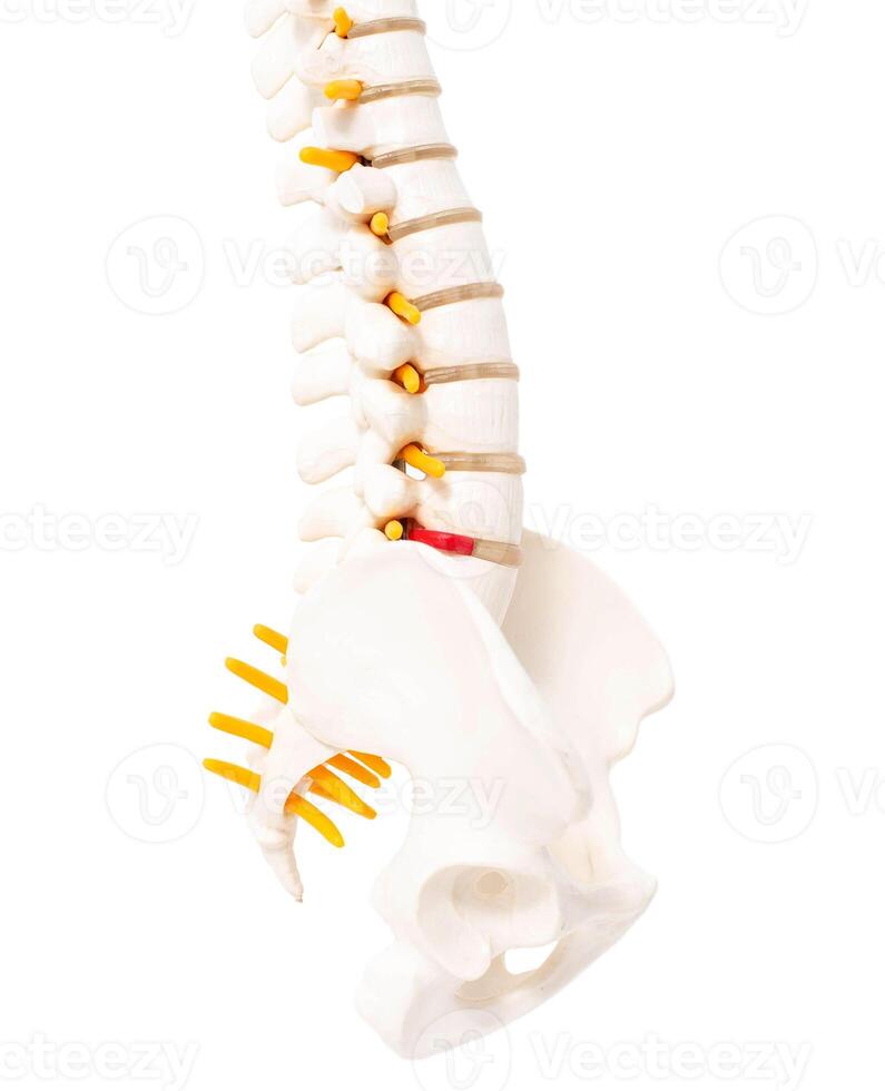 Lumbar spine and sacrococcygeal on a white background, isolate. Intervertebral hernia of the spine, rupture of the fibrous ring, neurological photo