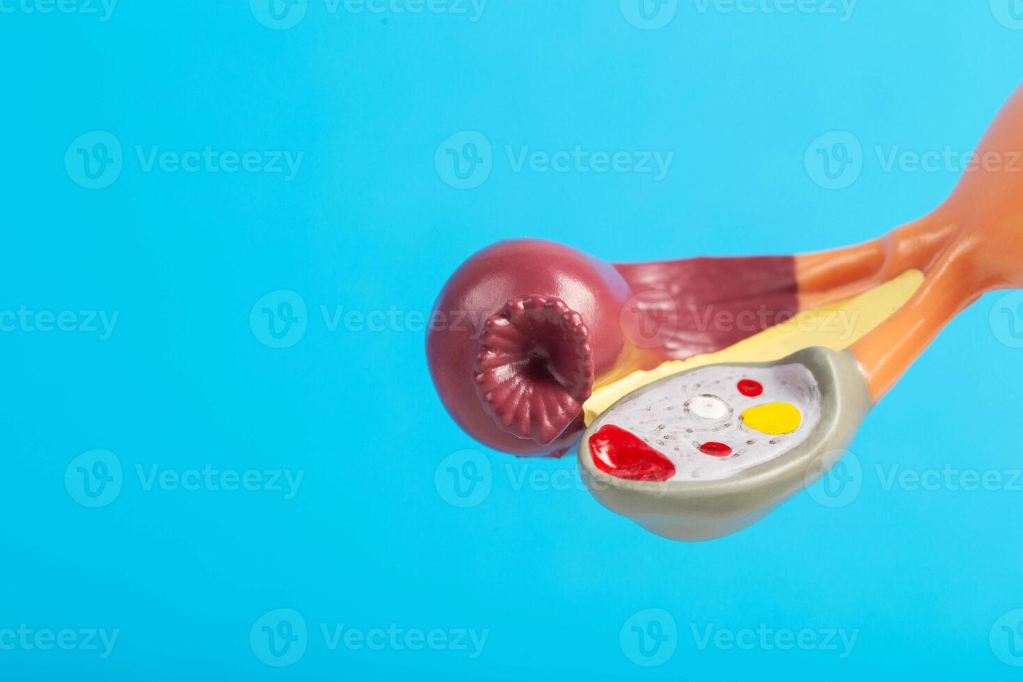 Female ovary close-up on a blue background of a medical mockup. The concept of ovary removal about cancer of the female reproductive system. Diseases and treatments of the ovaries. Copy space for text photo