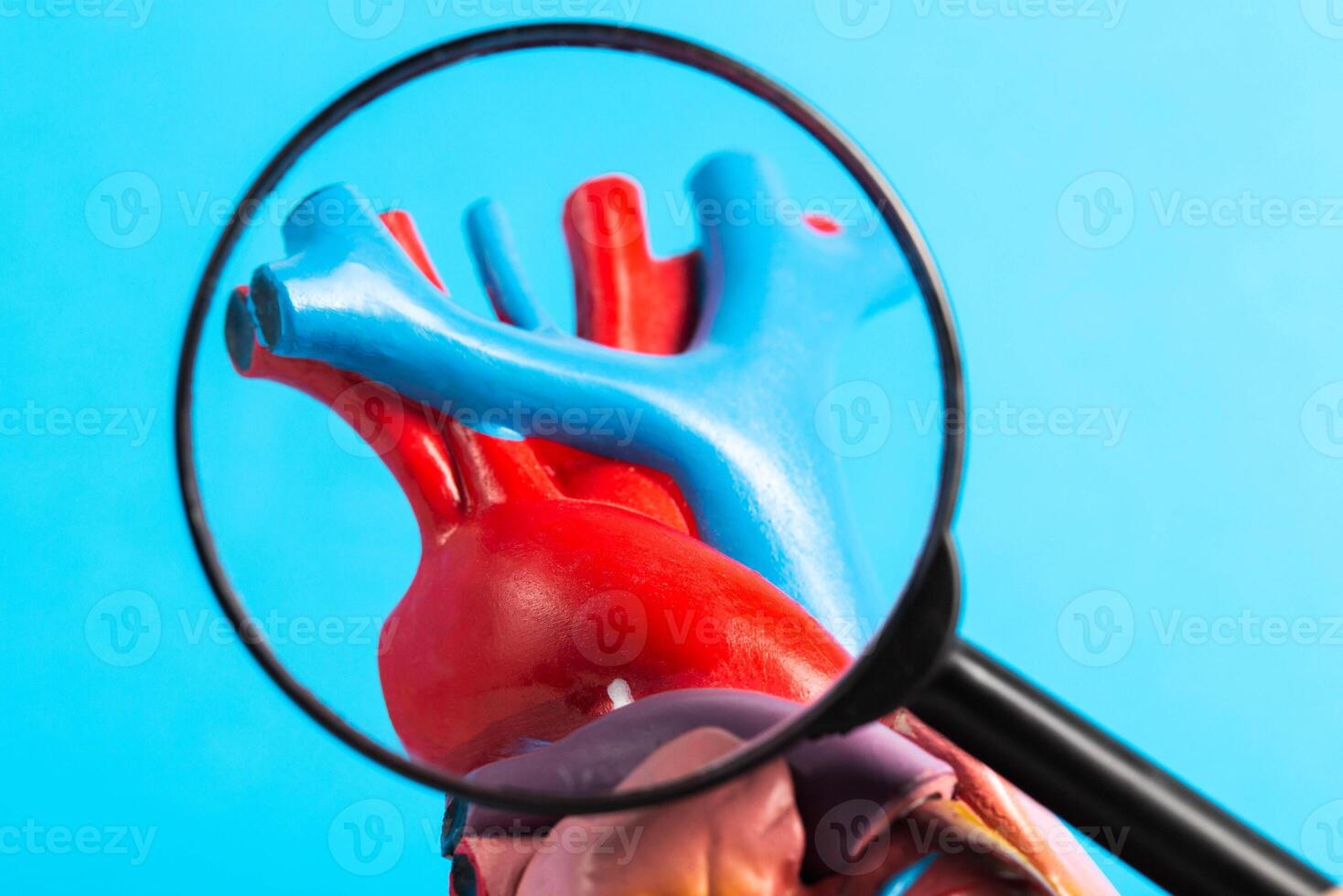 Coronary vessels of the heart under a magnifying glass on a blue background. Concept of examining heart vessels with coronary angiography, atherosclerosis. Close-up photo