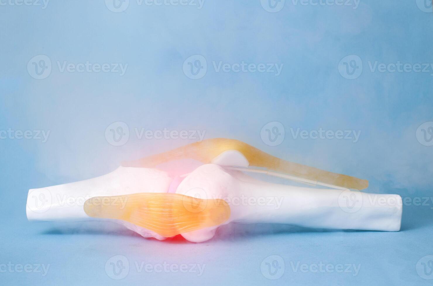 Knee joint mockup on a blue background and liquid nitrogen. Joint treatment concept with ozone therapy. Ultra-low temperature treatment photo