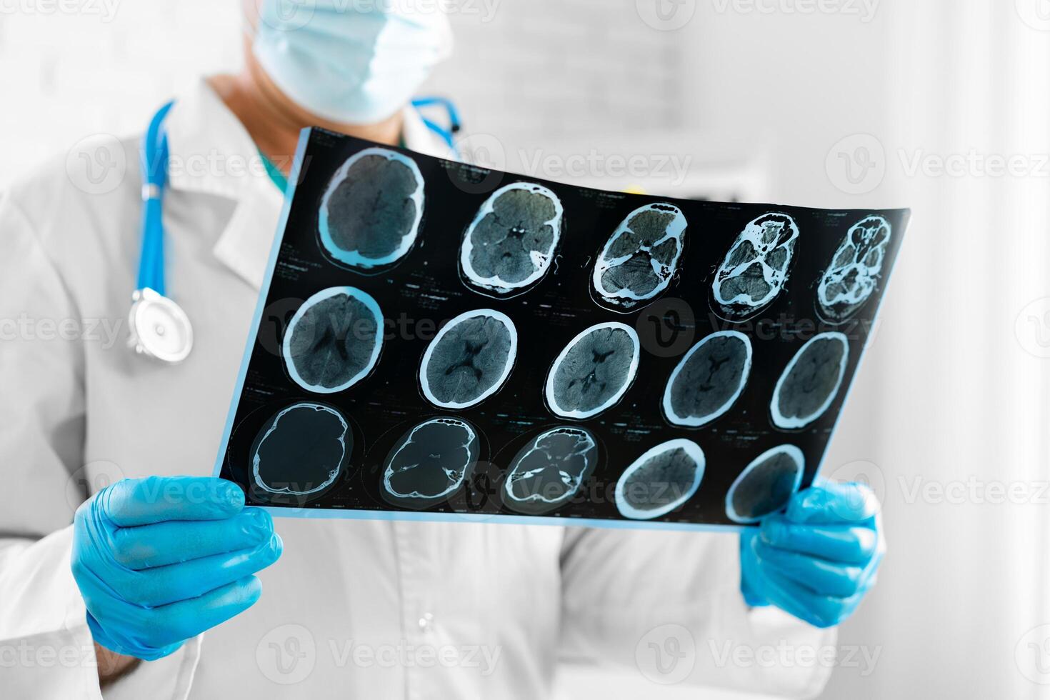 Hands of a doctor holding head scan photo