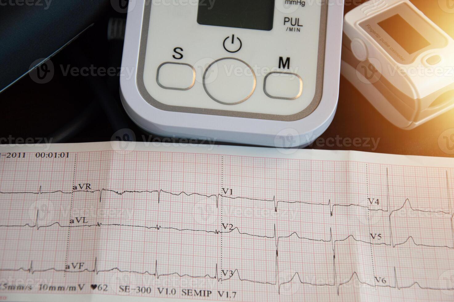 Concept of electrocardiogram, abnormal heart function detection, annual health checkup photo