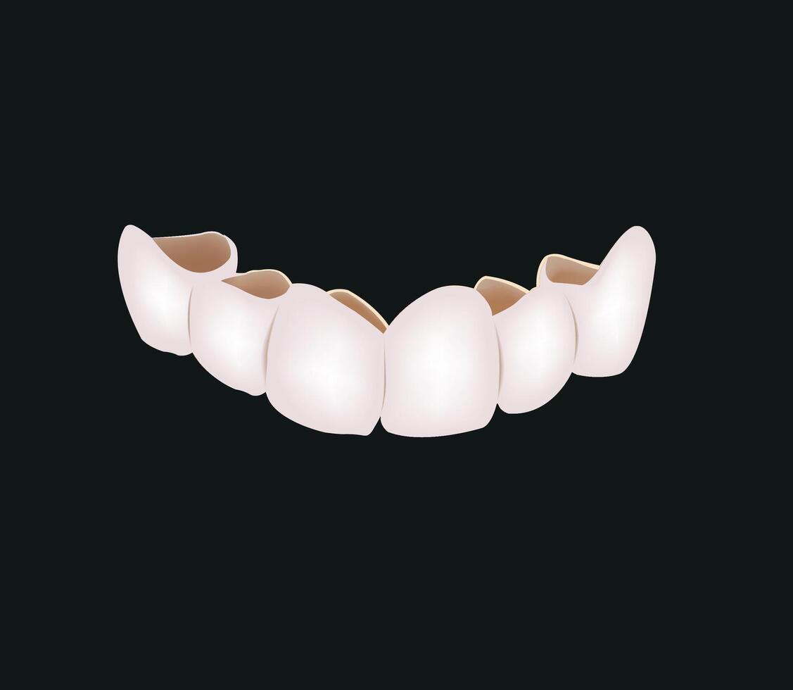 A tooth with a crown on it vector