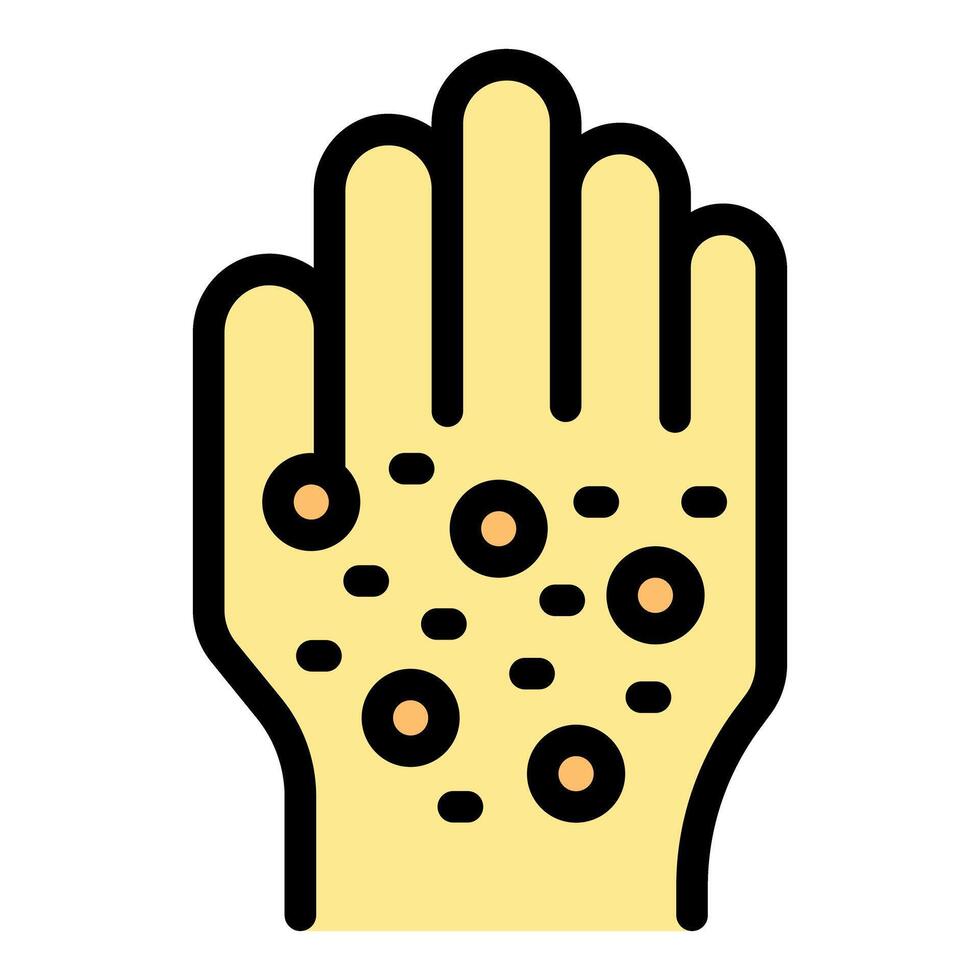 Hand showing symptoms of monkeypox infection with blisters and rashes vector
