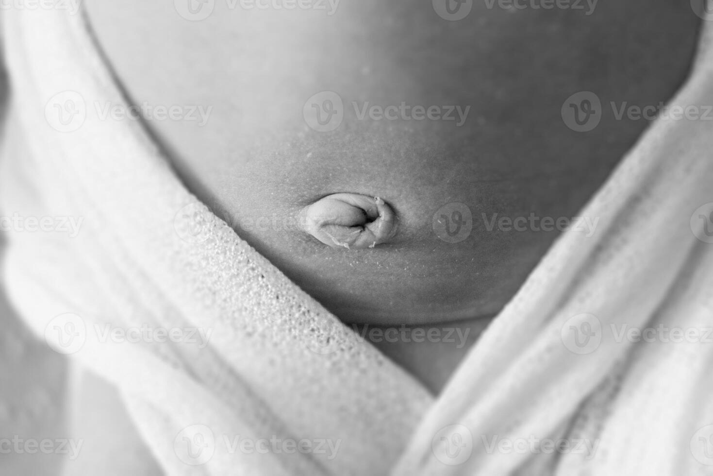 A close up of a baby's belly with a hole in it photo
