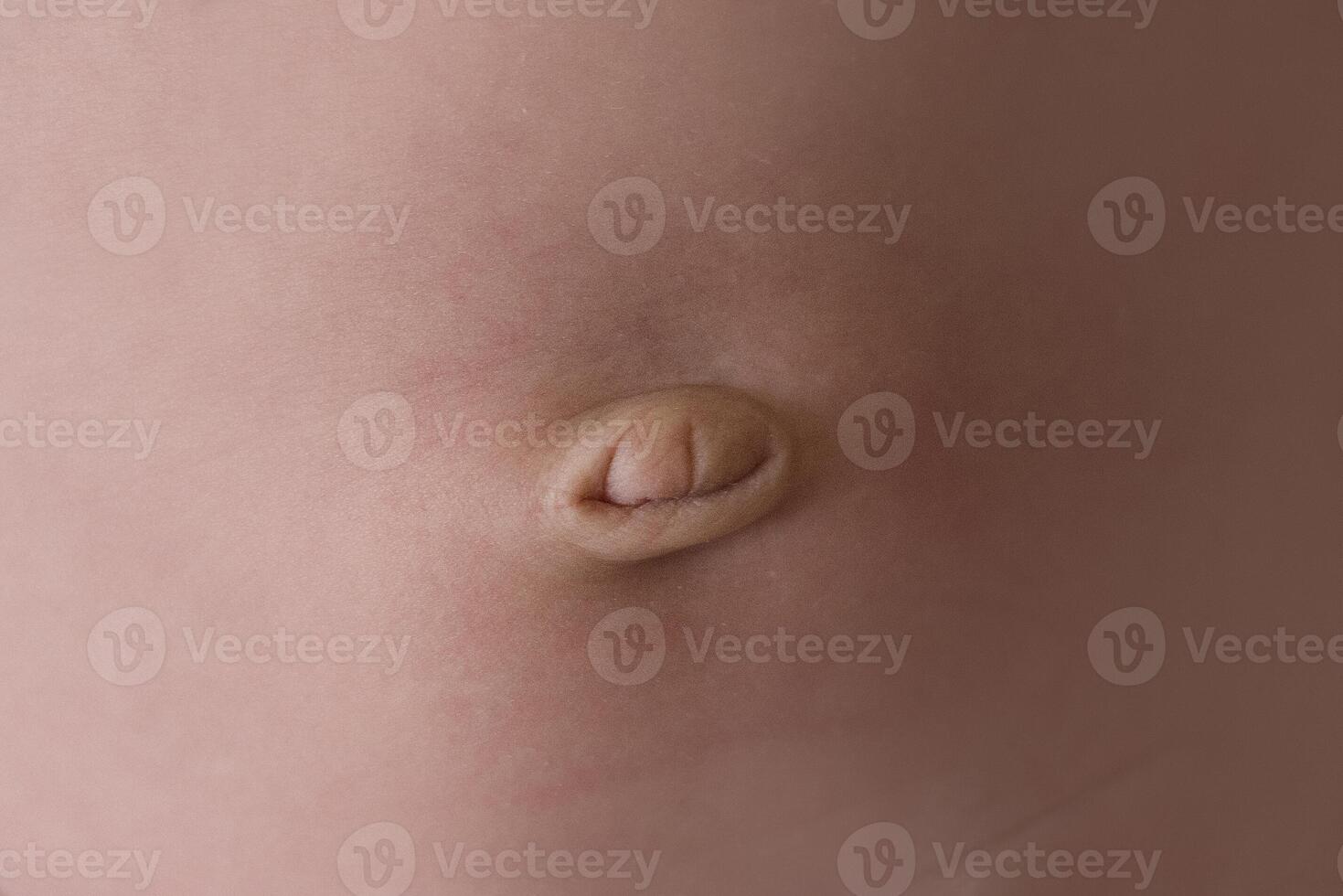 A close up of a baby's belly with a small hole photo